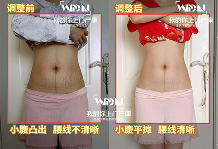 我的你上门产康极速瘦腹真实案例2